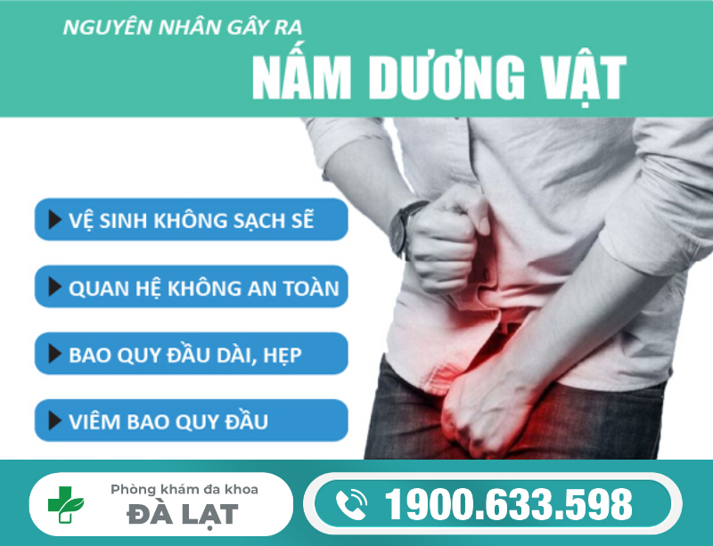 Hình ảnh minh họa